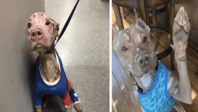 Photo of Severely Burned Pit Bull Defied The Odds And Is Now Loving Life